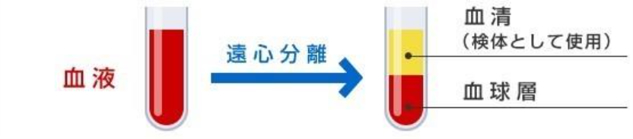 生化学検査 画像
